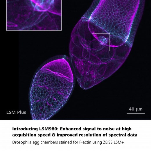 Introducing: ZEISS LSM 980 with Airyscan 2 for life science research To analyze life with as little disturbance as possible, you must use low labeling density for your biological models. This requires excellent imaging performance combined with low phototoxicity and high speed. LSM 980, your platform for confocal 4D imaging, is optimized for simultaneous spectral detection of multiple weak labels with the highest light efficiency. 1. Image with More Sensitivity & yield super-resolution quantitat