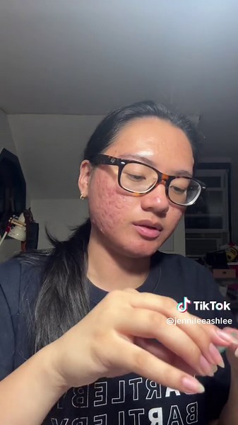 XL Microdart Pimple Patch Review and Application Experience