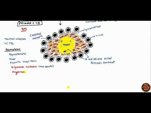 Tuberculosis for USMLE Step 1 and USMLE Step 2