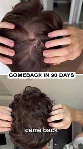 $880 → $21/Month. Limited-Time Offer. We will never do this again. Tired of losing hair? You’re not alone. 🧑‍🦲 Meet the breakthrough in hair regrowth — AlphaInfuse Hair Regrowth System. No side effects. No harsh chemicals. Just pure science restoring your hair back. Formulated for men like you battling hair loss. Our blend of Licorice Root Extract, Ginger Root, Black Sesame, and Citric Acid attacks the root cause of thinning. With micro-infusion technology, nutrients penetrate deep into the fo