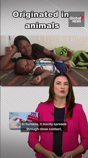 5 things you need to know about #mpox