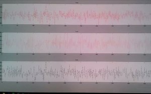 Arduino 的 Matlab 实时数据采集和绘图：振动传感器