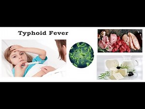 Enteric fever or Typhoid fever ; Definition, Causes, epidemiology, Pathogenesis, Symptoms, Treatment