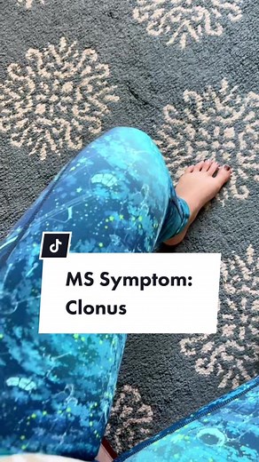 Understanding Clonus: Causes, Symptoms, and Management