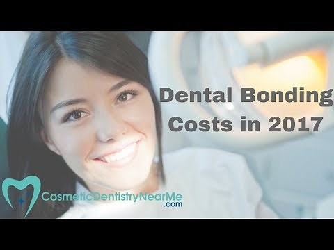 Dental Bonding Costs in 2017