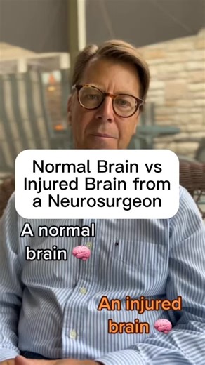 The difference between a normal brain and an injured brain 🧠 #brain #doctor #medicine | Dr. Brian Hoeflinger, MD
