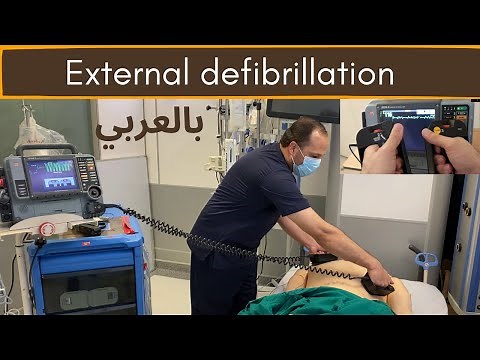 الصدمة الكهربائية في عملية الإنعاش القلبي: ما يجب أن تعرفه (DC shock)