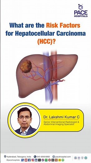 What are the Risk Factors for Hepatocellular Carcinoma (HCC)? | Factors Leading to Liver Cancer