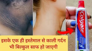 837K views · 23K reactions | 15 Minutes me kali gardan ko gora karne ka sabse acha upaay | Skin Whitening Treatment | Remove Pigmentation Instantly | Cooking & Desi Gharelu Nuskhe | Facebook