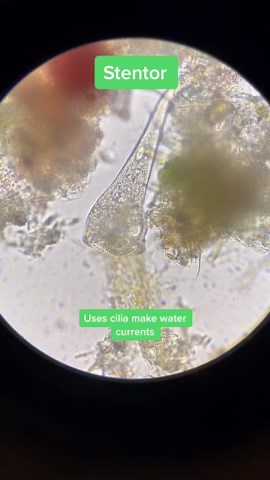 Stunning Close-Ups of Bacteria and Microorganisms