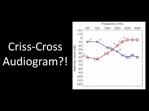 Don't get tricked by this audiogram! Masking tutorial