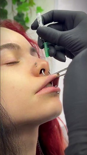 This is a Medusa Lip Piercing 👄