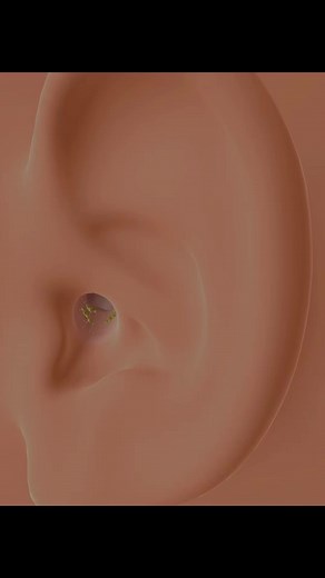 ASMR Cleaning Deeply Ear Dust Animation | #facebookreels #asmrvideo #videos #asmrsatisfying #viralshorts #asmrcommunity #asmrcleaning #FacebookReelsContent #asmreating #viralreels2024 #facebookreel | ASMR