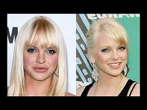 Anna Faris Plastic Surgery Before and After