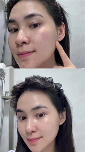 Routine dưỡng trắng & mờ thâm sau mụn với Nia 23   DSP Bright