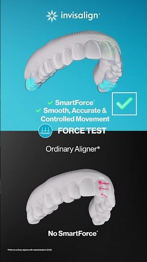 Tried, tested, and trusted aligners from Invisalign