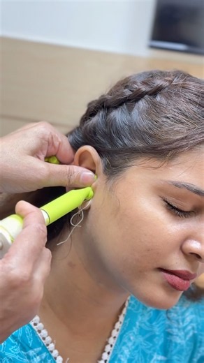 How Ear Impressions Are Taken for RIC, CIC, ITC & IIC Hearing Aids | Phonak, Signia, ReSound, Oticon