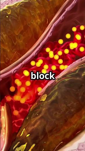 What Happens If You Surface Too Fast? 🤿 | Decompression Sickness Explained #shorts #medicaleducation