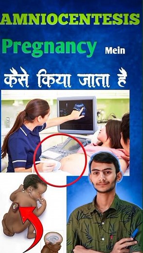 Amniocentesis #shorts #pregnancy