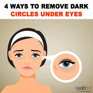 Best Ways to Get Rid of Dark Circles Under Your Eyes Fast #health #eye #fitness #wellness | Health