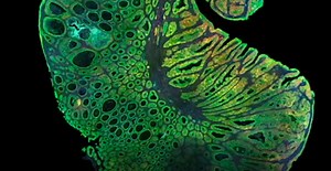 A Look at the Tumor Microenvironment | Videos