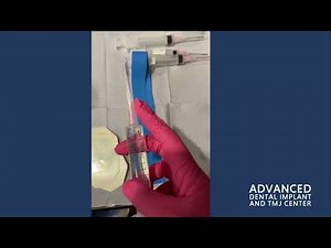 IV Sedation in Dentistry: A Lifeline for Patients with Dental Phobia