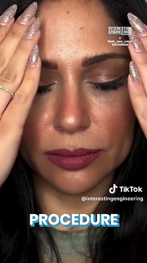 A process of laser keratopigmentation is advancing the art of eye color changing. A powerful laser punctures the eyeball, and chosen pigment is almost instantly inserted. Suddenly, you have the eyes of a stranger - or the real you. #EyeColorChange#LaserEyeColor#VisionaryBeauty