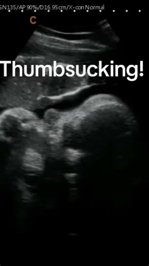 An important skill for baby to learn in utero. This will help baby latch on to nurse once born!