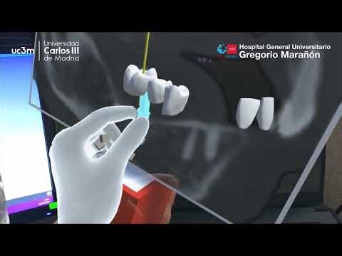 Augmented Reality application on Microsoft HoloLens 2 for Planning Dental Implants Placement