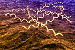 Health Department Reports Significant Increase in Syphilis Cases