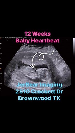 12 Weeks 5 Days Baby Heartbeat 💓 #jerbearimaging #ultrasoundnearme #electiveultrasound #UltrasoundCenter #heartbeat #babyheart #babyheartbeat #growbabygrow #12weeks5days #cutebabies #babycute #babyinthewomb #BookOnline #brownwoodtx www.jerbearimaging.com | JerBear Imaging