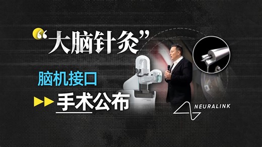 【氪大事】1.5秒一次，128针，Neuralink手术全流程公布