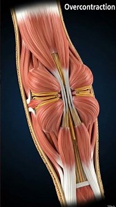 organophosphate compound