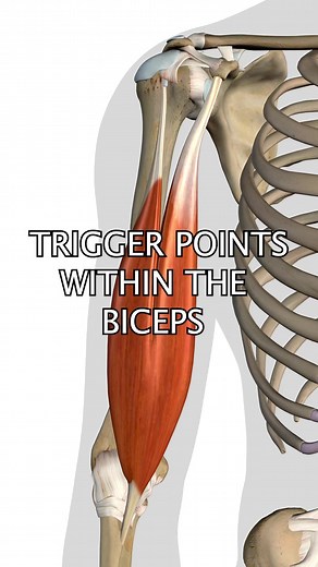 Biceps Trigger Points #biceps #triggerpoints #triggerpointtherapy For more information about NAT online course, please visit www.nielasher.com | NAT Global Campus