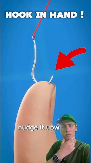 How to remove a hook from your finger by Zach D films!?! #shorts #fishing ￼