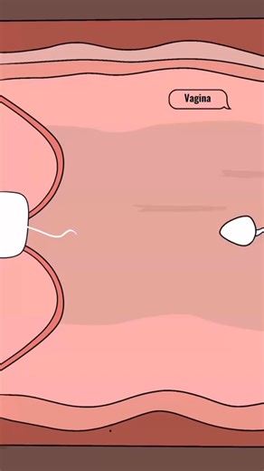 63K views · 1K reactions | How does the copper IUD actually work? | Health manager 2d | Facebook