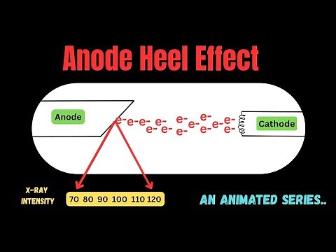 Anode Heel effect ll Animated series ll radiography simplified