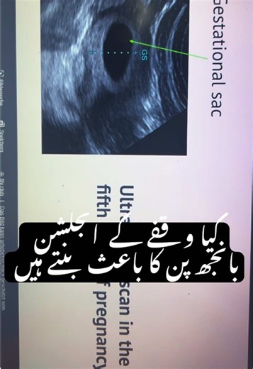 Understanding the Pregnancy Journey: Insights and Tips