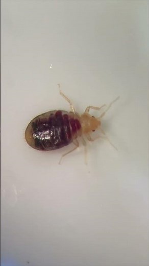 🤮😫Live bed bug crawling around under microscope (dermatoscope)