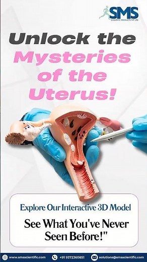 👩‍⚕️ Uterus 3D Model: Enhancing Patient Education on Female Reproductive Health 🩺✨