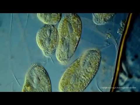 Various Ciliated Protozoa. Kingdom Protista. DIC Lighting Technique.