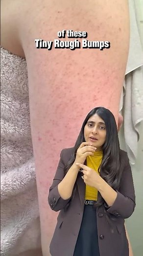 Strawberry Skin or Keratosis Pilaris? How to treat Strawberry Skin?