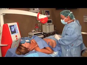 Part 2 of GPS Liposuction Procedure