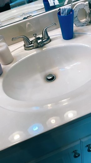 Pt.1 of cleaning my braces 😁 #fyp #fypシ #ihavebraces #cleaningmybraces #lol