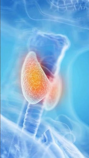 El procedimiento de una biopsia de tiroides