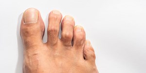 The One 'Pimple' You Absolutely Shouldn't Pop