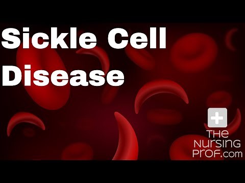 Sickle Cell Disease and Sickle Cell Crisis