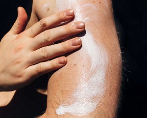 The Most Effective Way to Soothe and Heal a Sunburn, According to Derms We Trust