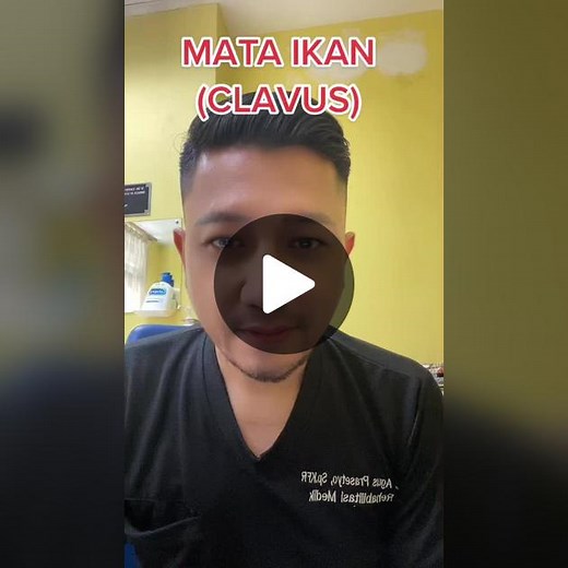Mata Ikan: Ciri, Penyebab, dan Pengobatan yang Efektif