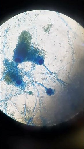 Aspergillus structures in LPCB tease mount of Culture(CMA) #microscope #shorts